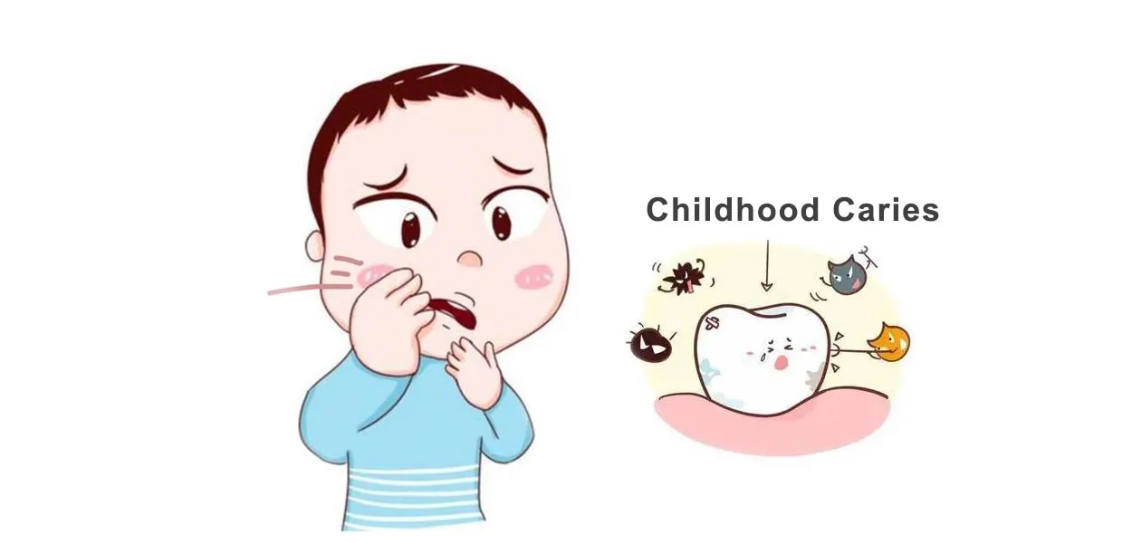 dental caries in children