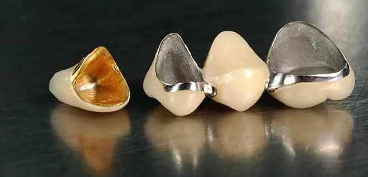 dental crown materials