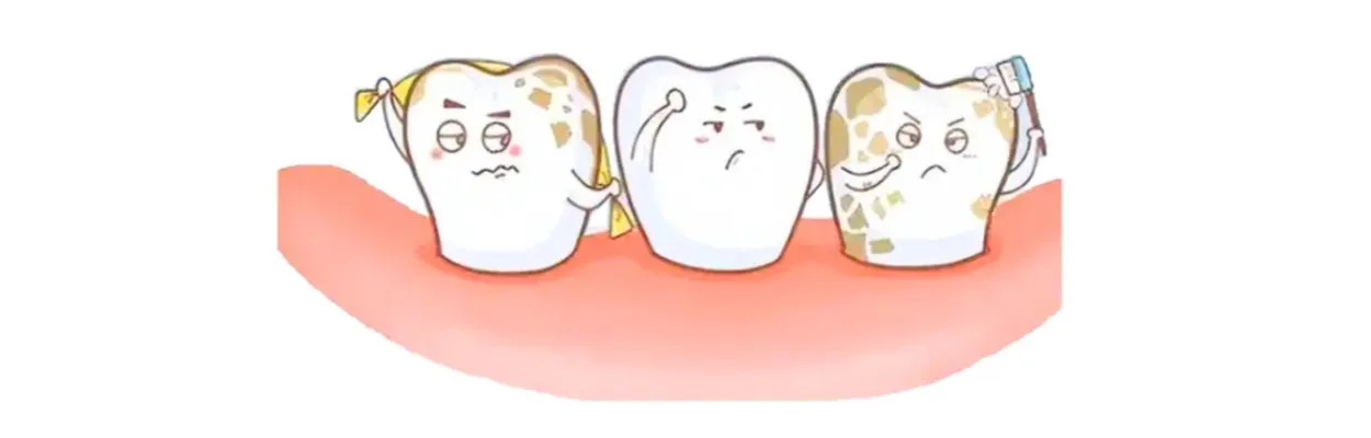Chemical nature of caries