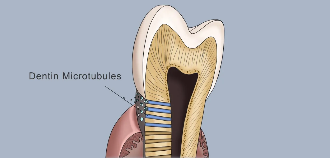 Explore the mechanism of tooth sensitivity