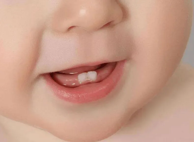 Teeth Eruption Chart and Related Dental Knowledges Guide