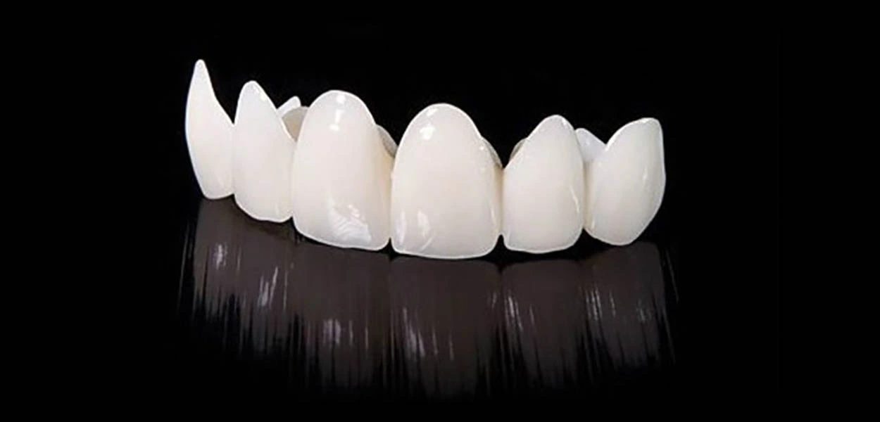 What is Zirconia Dental Crown Implants and Prices