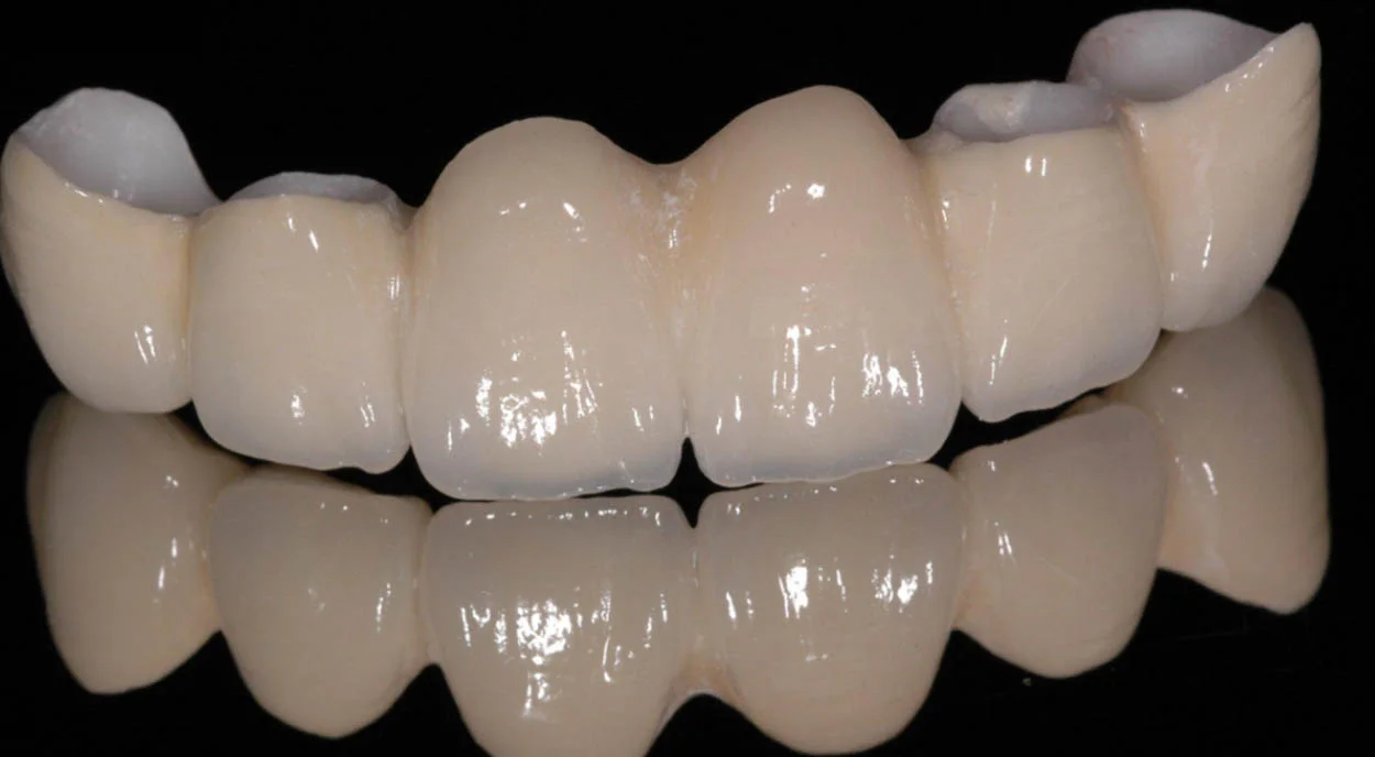 natural and beautiful - Zirconia All-Ceramic Crown